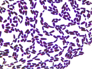 Gram-stained yeast magnified 1000X