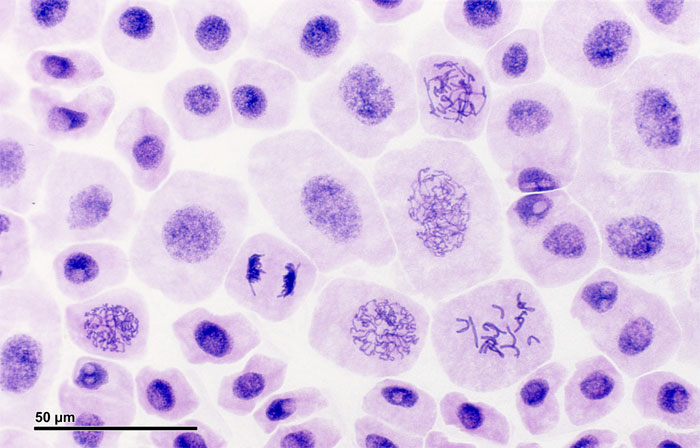 Figure 1.13. Chromosomes formed during mitosis.