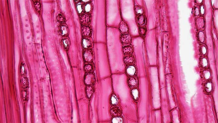 Figure 2.10.a. Tracheids in tangential section in Quercus